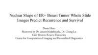 Multiple Instance Learning Predicts Patient Outcome from the Nuclear Shape in both Lymph Node Positive and Negative ER+ Breast Cancer H&E Slides 